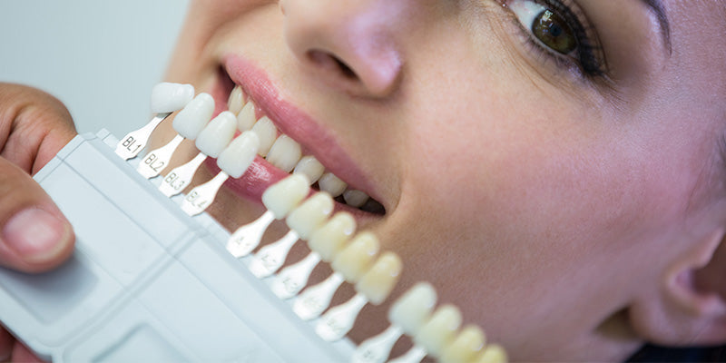 How to Get Rid of Staining on Teeth Without Harsh Chemicals