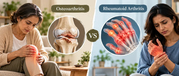 Osteoarthritis vs Rheumatoid Arthritis: Key Differences