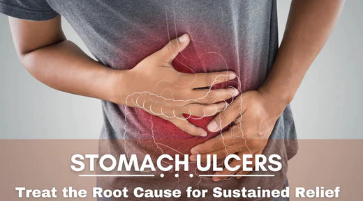 Your Guide to Ayurvedic treatment for Stomach Ulcer