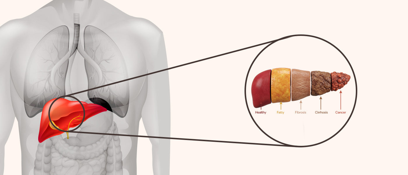 Feeling Sluggish? Signs Your Liver Is Struggling & What Helps