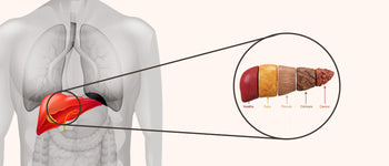 Signs Your Liver Is Struggling 